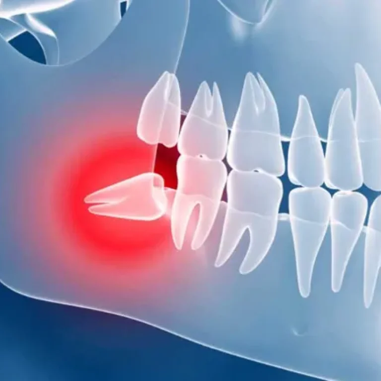 dente-del-giudizio